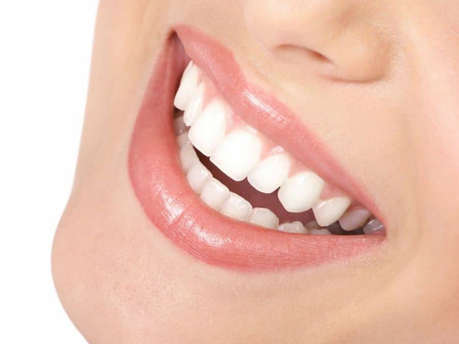 Una revolución en Estética Dental – Implantes Dentales